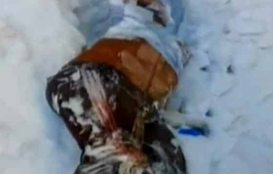 Операция мальчика без уха из Уральска может сорваться из-за нехватки денег