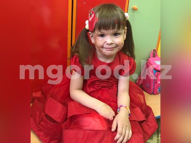 «Почему мне отрезали пальчики»: девочка из Уральска перенесла 8 операций