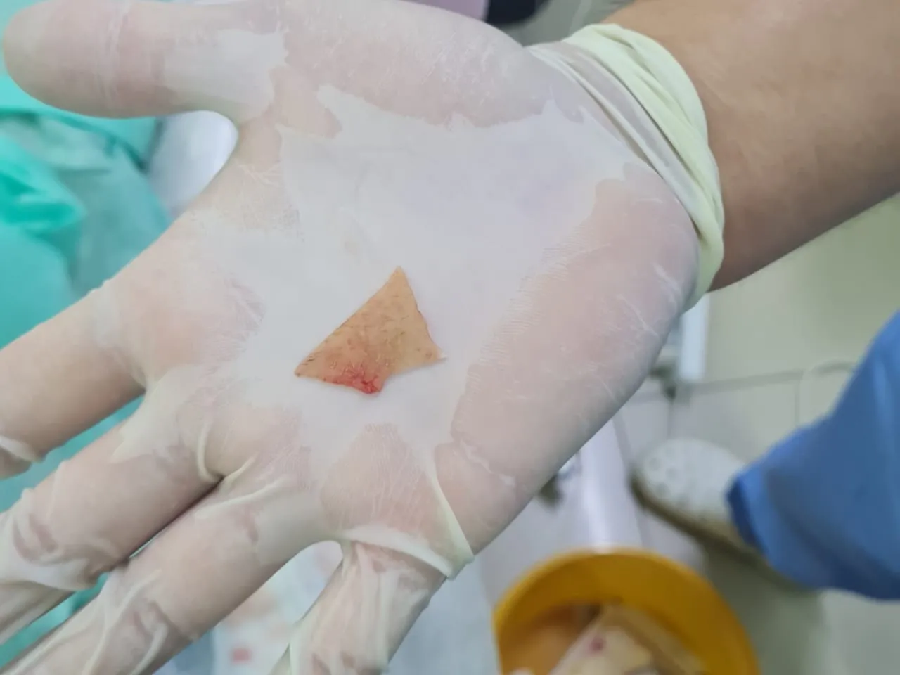 Врачи спасли проглотившую кость жительницу Алматинской области