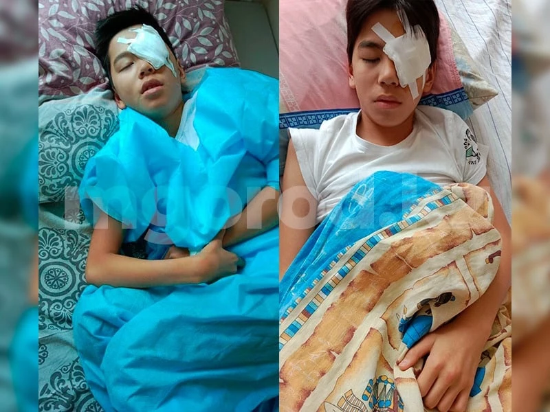 Уральскому подростку не могут вылечить атрофию зрительного нерва