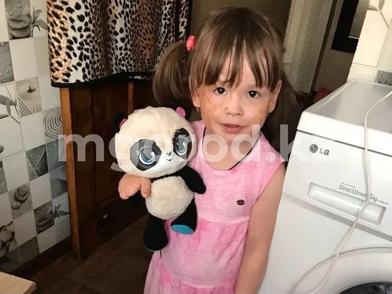 «Когда вырастут мои пальцы» — пострадавшая в пожаре девочка из Уральска