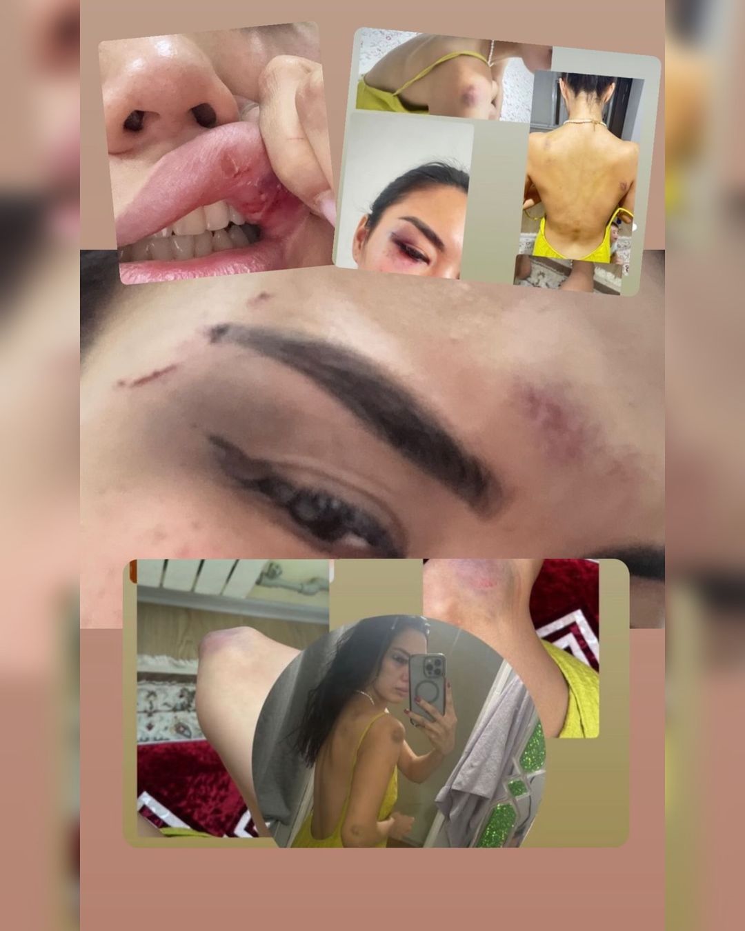 «Второй Бишимбаев»: бывший парень жестоко избил девушку в Актау