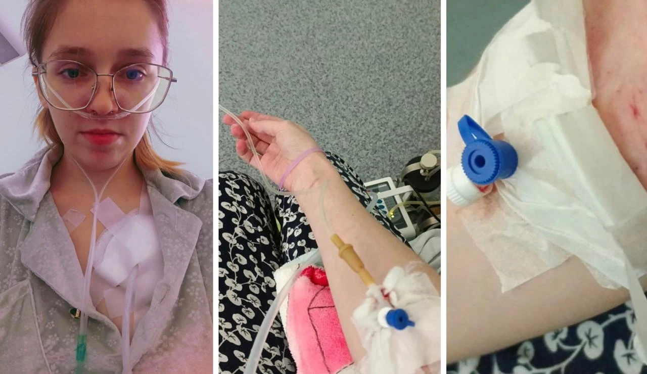 Девушке из ЗКО с редким заболеванием нужна трансплантация, но помощь оказалась недоступной