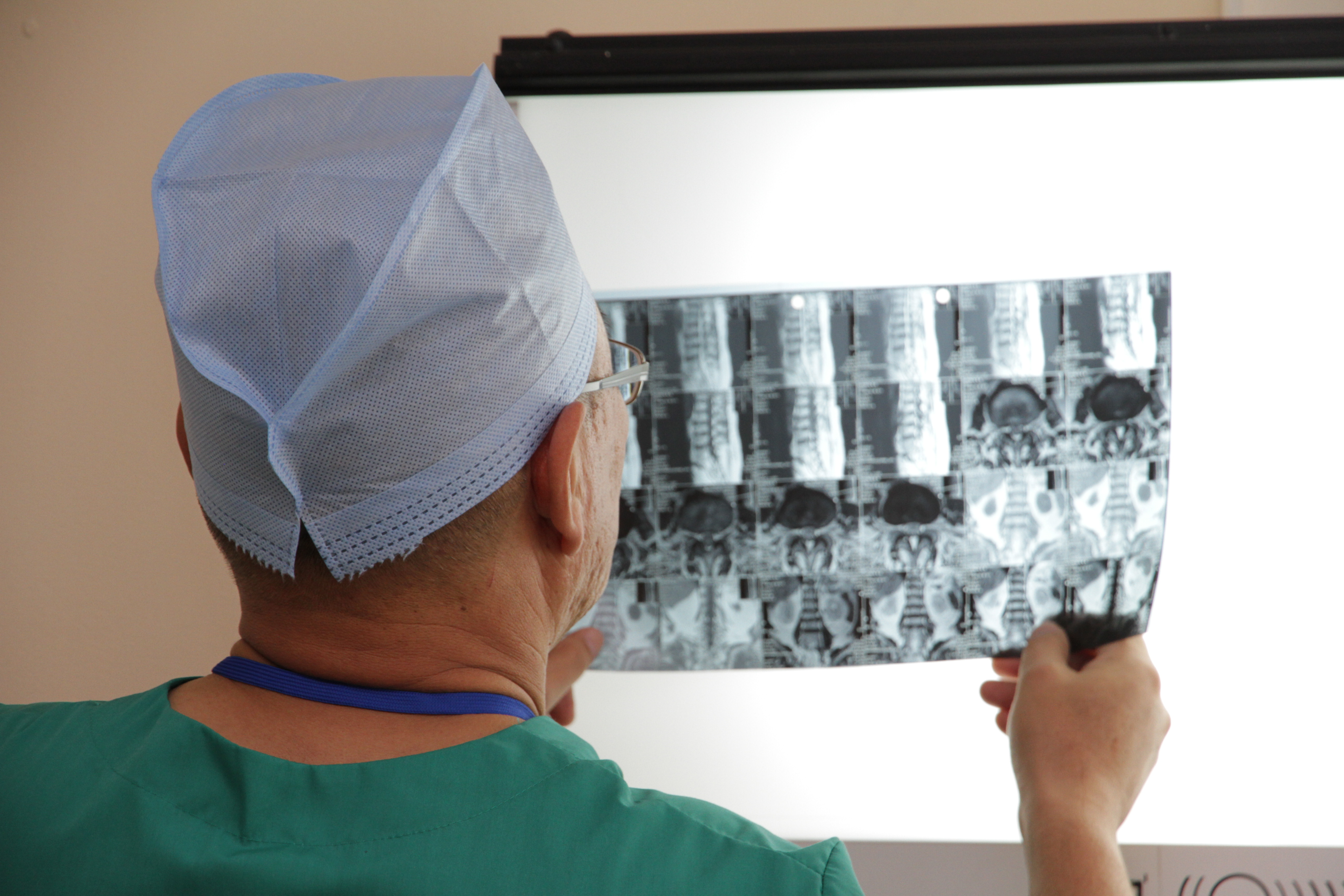 БҚО-да 85 адам фтизиопульмонологиялық орталықта емделіп жатыр