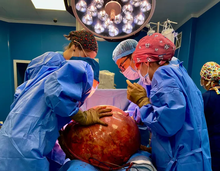 30-килограммовую раковую опухоль извлекли у женщины казахстанские врачи