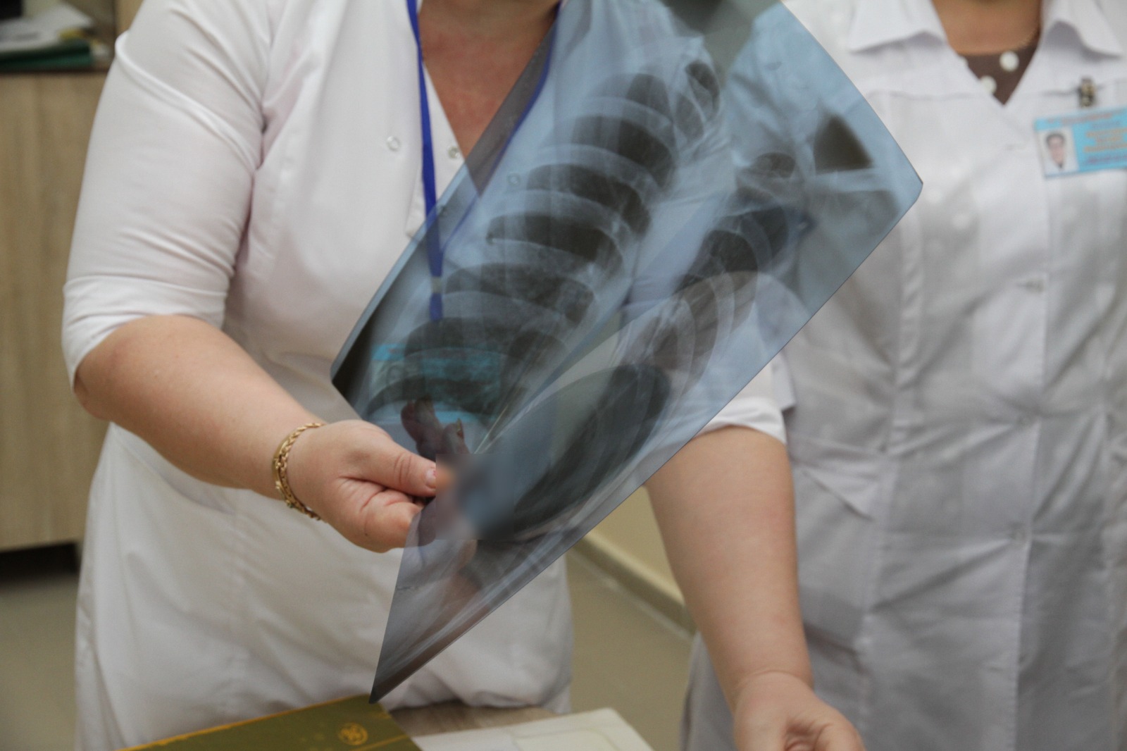 2024 жылы Қазақстанда 4000 астам туберкулезге шалдыққан науқас анықталды