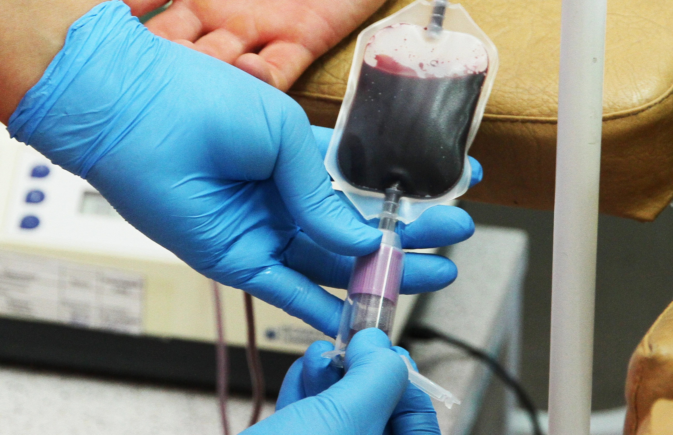 Сколько в Казахстане детей с ВИЧ