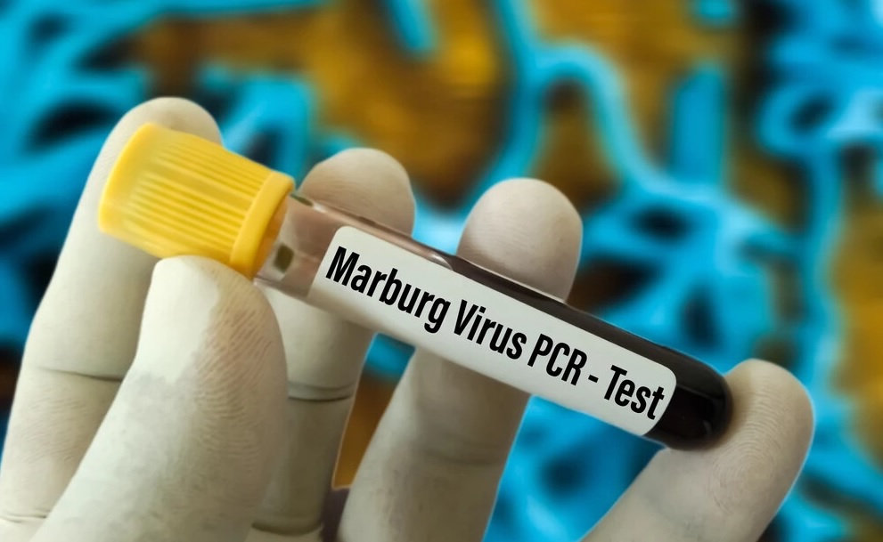 Вспышка вируса Марбург: Минздрав Казахстана усиливает контроль