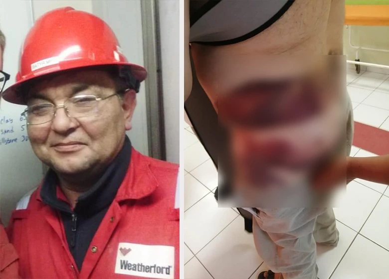 Несчастный случай на производстве в ЗКО: два года дело не могут довести до суда